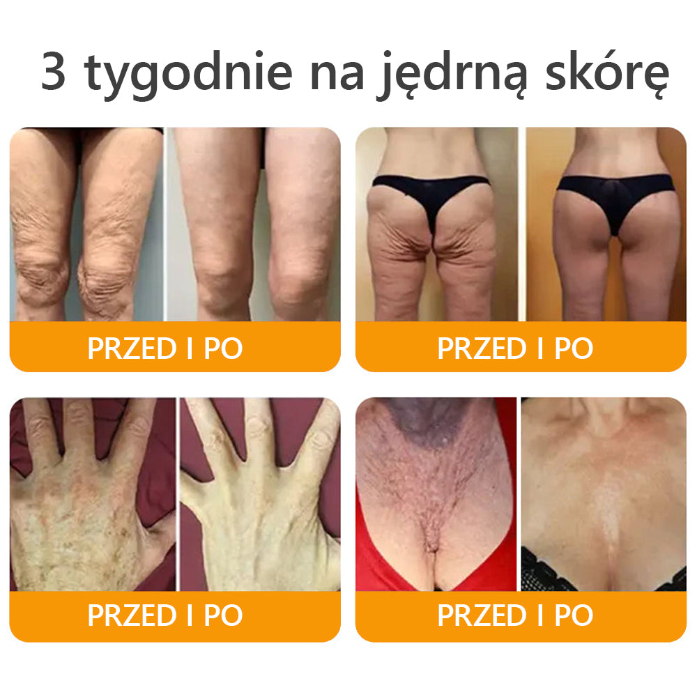 Wyprodukowano i wysłano z Polski ✅🎁𝐀𝐖𝐙𝐋𝐎𝐕𝐄® Kompleksowy krem z jadem🐅 pszczelim | OSTATNI DZIEŃ 80% ZNIŻKI🐅