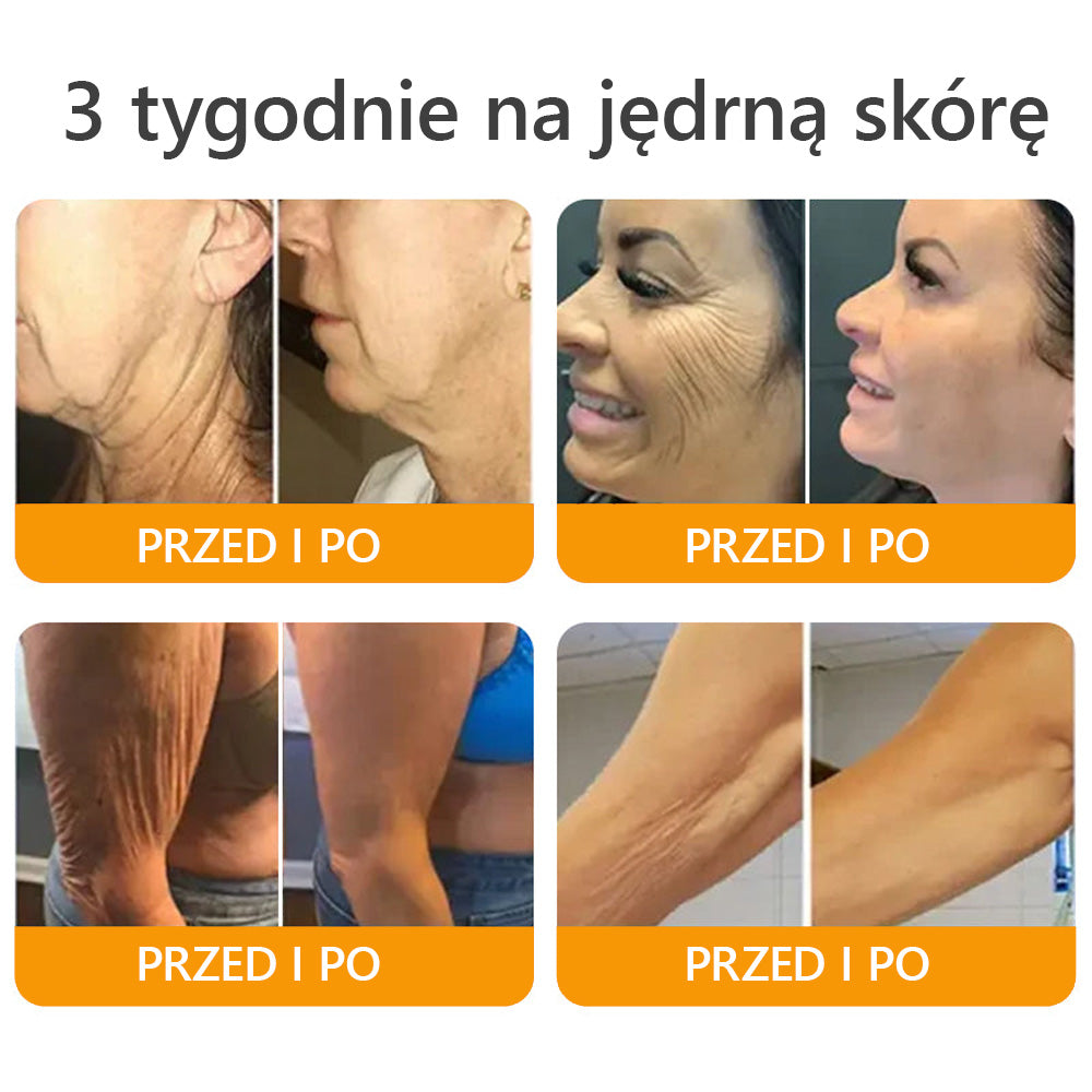 Wyprodukowano i wysłano z Polski ✅🎁𝐀𝐖𝐙𝐋𝐎𝐕𝐄® Kompleksowy krem z jadem🐅 pszczelim | OSTATNI DZIEŃ 80% ZNIŻKI🐅